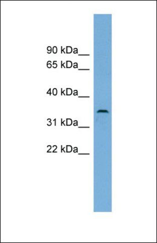 Anti-C3orf49 antibody produced in rabbit