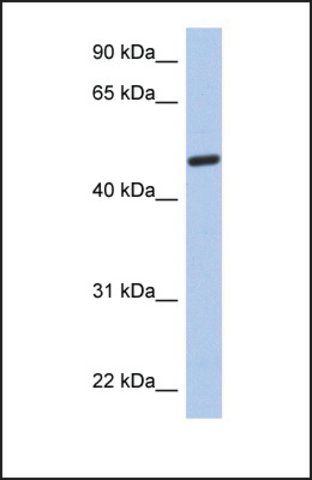 Anti-C2ORF62, (N-terminal) antibody produced in rabbit