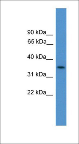 Anti-C4orf19 antibody produced in rabbit