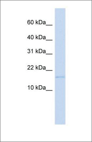 Anti-C3orf18 antibody produced in rabbit