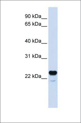 Anti-C1QTNF1 antibody produced in rabbit