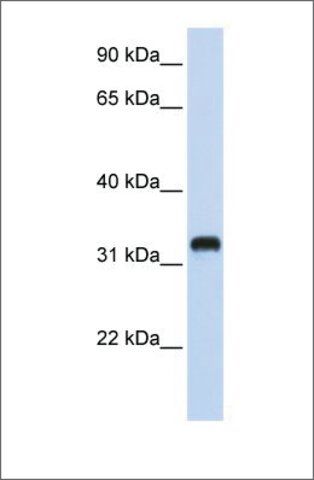 Anti-C21orf62 antibody produced in rabbit