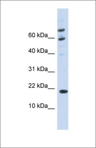 Anti-C21ORF87 antibody produced in rabbit