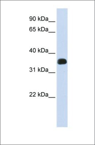 Anti-C2orf47