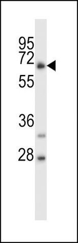 ANTI-C4ORF18 (CENTER) antibody produced in rabbit