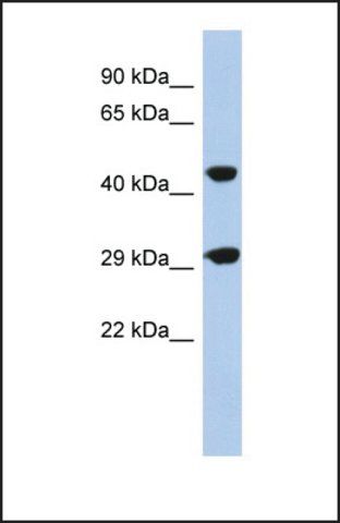 Anti-C22ORF25, (N-terminal) antibody produced in rabbit