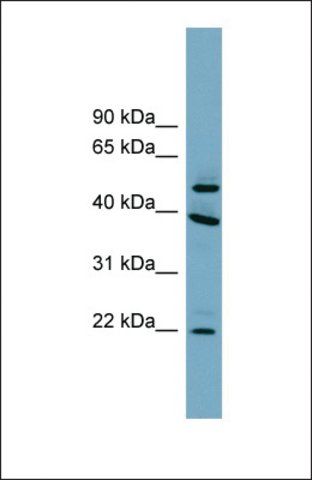 Anti-C4ORF20 antibody produced in rabbit