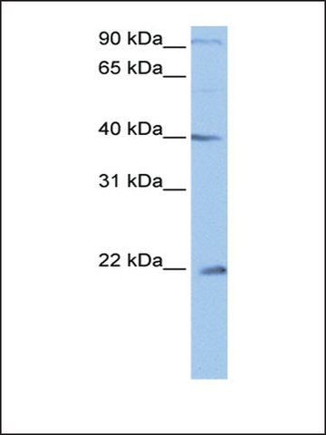 Anti-C4orf33 antibody produced in rabbit