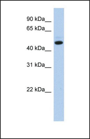 Anti-C5ORF36, (N-terminal) antibody produced in rabbit