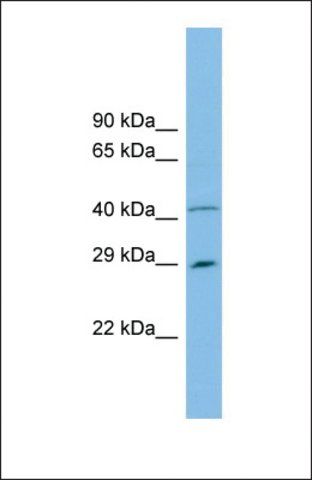 Anti-C9ORF152, (N-terminal) antibody produced in rabbit