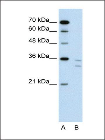 Anti-CD8B antibody produced in rabbit