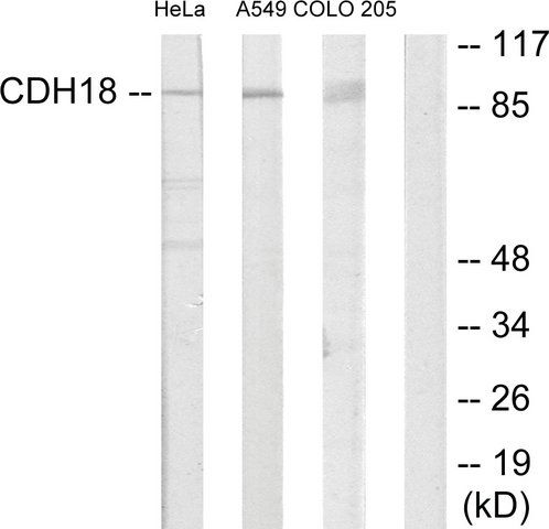 Anti-CDH18 antibody produced in rabbit