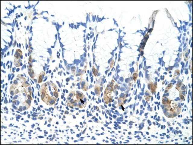 Anti-ADAT1 antibody produced in rabbit