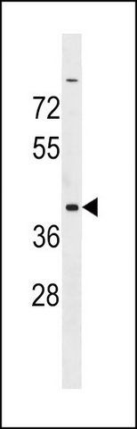 ANTI-ADAT3 (N-TERM) antibody produced in rabbit