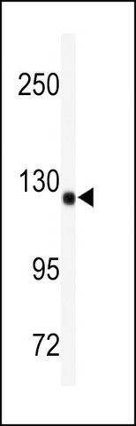 ANTI-ADAMTS19 (CENTER) antibody produced in rabbit