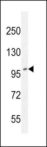 ANTI-ADAMTS10 (N-TERM) antibody produced in rabbit