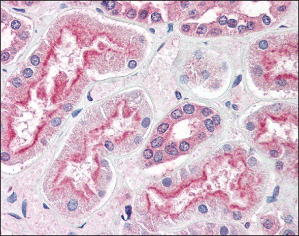 Anti-ADAM20 antibody produced in rabbit