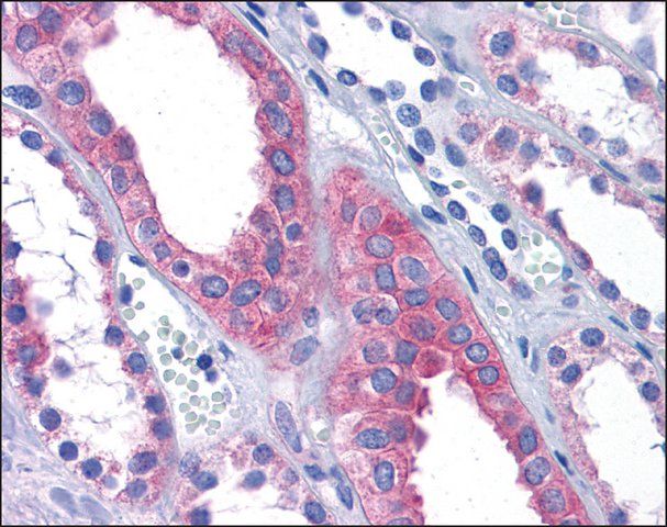 Anti-AFAP1L2 / KIAA1914 antibody produced in rabbit