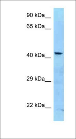 Anti-ADAT3 antibody produced in rabbit