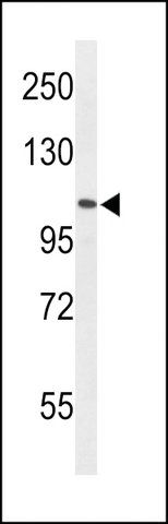 ANTI-AF5Q31(N-TERMINAL) antibody produced in rabbit