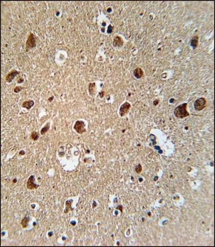 ANTI-AFTPH (C-TERM) antibody produced in rabbit