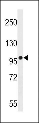 ANTI-AGAP3(N-TERMINAL) antibody produced in rabbit