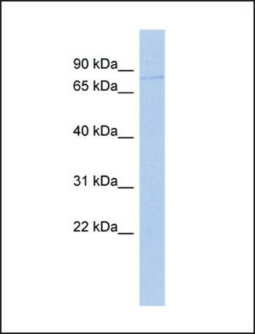 Anti-ADRBK2, (N-terminal) antibody produced in rabbit