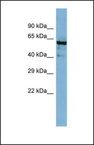 Anti-ANGPT4, (N-terminal) antibody produced in rabbit