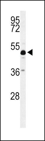 ANTI-ANKH(C-TERMINAL) antibody produced in rabbit