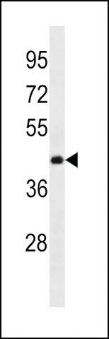 ANTI-ANKRD63 (CENTER) antibody produced in rabbit