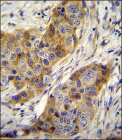 ANTI-ANR39 (C-TERM) antibody produced in rabbit