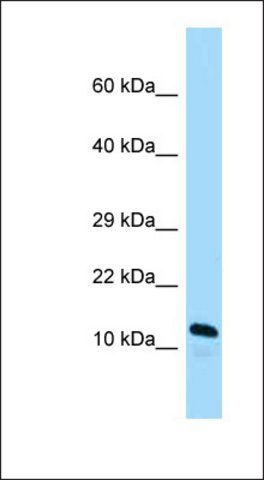 Anti-ARL2BP antibody produced in rabbit