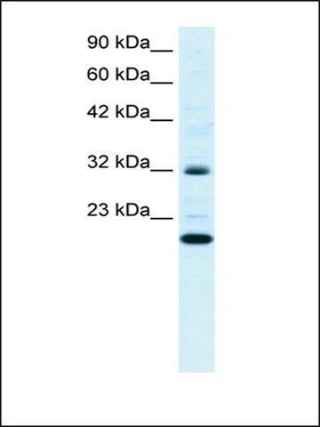 Anti-ARHGDIG antibody produced in rabbit