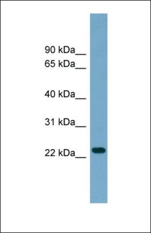 Anti-ARL8B antibody produced in rabbit