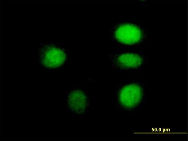 Anti-ARNT antibody produced in mouse