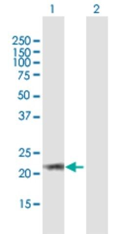 Anti-ARL6 antibody produced in mouse