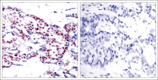 Anti-ATF2 (Ab-71 or 53) antibody produced in rabbit