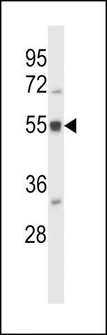 ANTI-BAIAP2L2(N-TERMINAL) antibody produced in rabbit