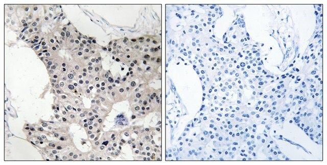 Anti-BAGE4 antibody produced in rabbit