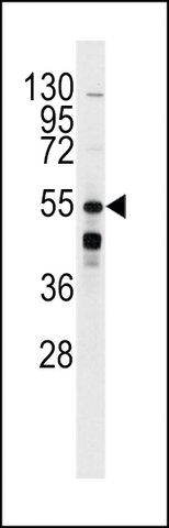 ANTI-BAR2 (S261) antibody produced in rabbit