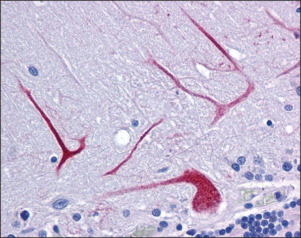 Anti-BANP antibody produced in rabbit