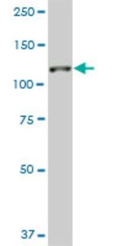 Monoclonal Anti-SH3MD2 antibody produced in mouse