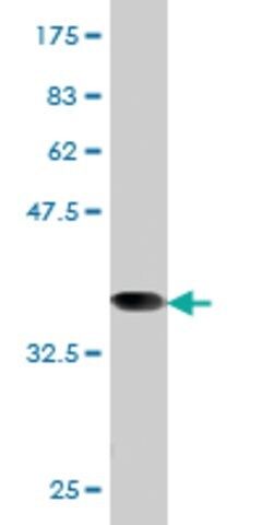 Monoclonal Anti-RRM1 antibody produced in mouse