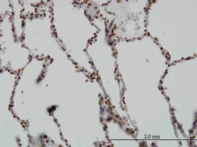 Monoclonal Anti-SGK, (N-terminal) antibody produced in mouse