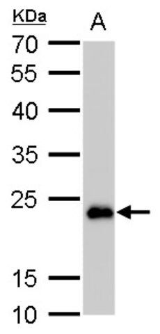 Monoclonal Anti-SOD2 antibody produced in mouse