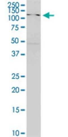 Monoclonal Anti-SKIV2L antibody produced in mouse