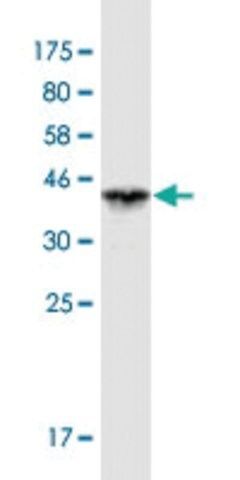 Monoclonal Anti-VPS33B antibody produced in mouse