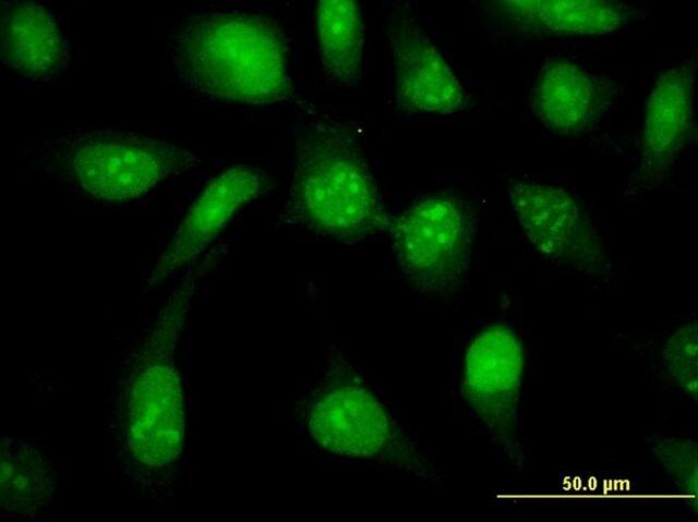 Monoclonal Anti-UBE2N antibody produced in mouse