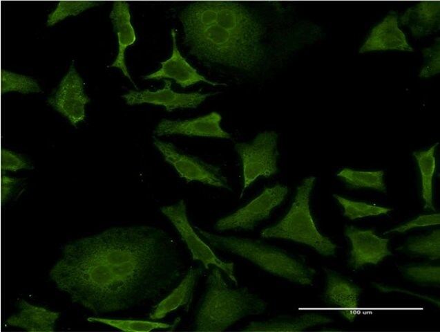 Monoclonal Anti-ISCU antibody produced in mouse