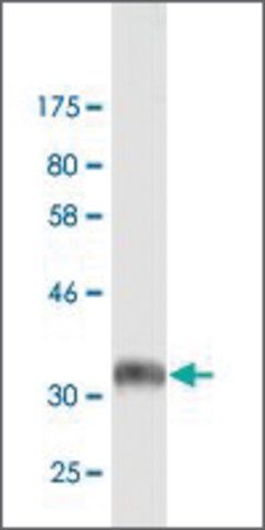 Monoclonal Anti-ITGB5 antibody produced in mouse